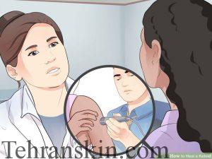 %da%86%da%af%d9%88%d9%86%da%af%db%8c-%d8%af%d8%b1%d9%85%d8%a7%d9%86-%da%a9%d9%84%d9%88%d8%a6%db%8c%d8%af0