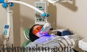 استفاده ازلیزربرای سفید کردن دندان ها