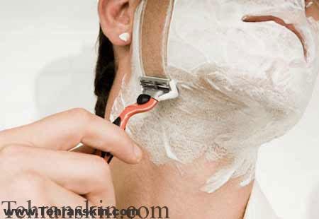 قبل از لیزر موهای زائد به این نکات حتما توجه کنید !!!