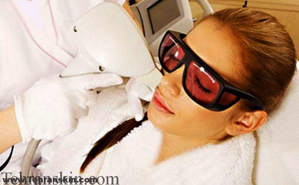 هر آنچه باید در مورد دستگاه الکساندریت دانست !