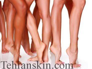 حذف موهای زائد برای پوست های تیره در مرکز لیزر برکه