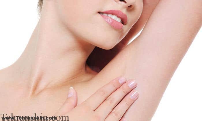 لیزر موهای زیر بغل