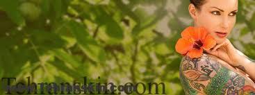 لیزر موهای زائد ناحیه تناسلی زنان و مردان