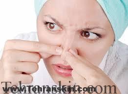 جوش های سرسیاه پوست