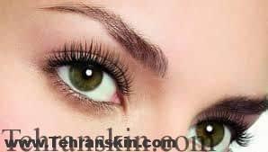 آیا می خواهید بدون انجام درمان های غیرجراحی چشمانی جوان و شاداب داشته باشید؟