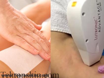 12 کاری که نباید پس از جلسه اول لیزر موهای زائد انجام بدهیم | آدرس مرکز لیزر و زیبایی برکه