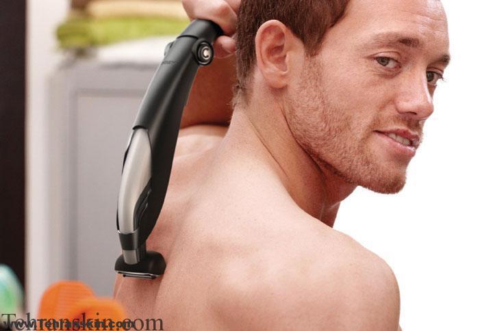 تعداد جلسات لیزر موهای زائد