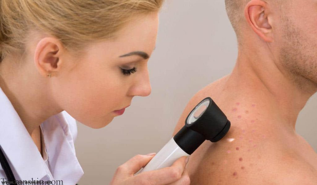 مهمترین عوارض لیزر در رفع موهای زائد