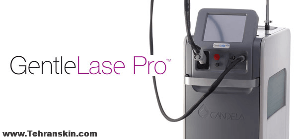 الکساندرایت کندلا جنتل مکس پرو