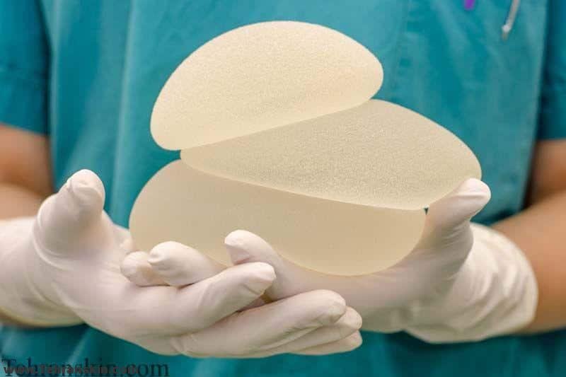 پروتز سینه تا چه مدت باقی می ماند؟ بهترین دکتر پروتز سینه