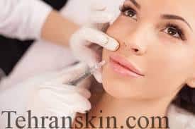 تزریق پرکننده به لبها