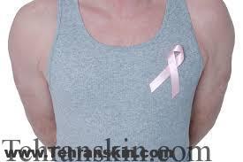 علائم سرطان مردان