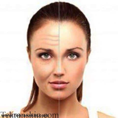 چروک های صورت خود را با این روش ها از بین ببرید | جوان سازی صورت