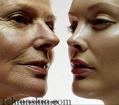 چروک های صورت خود را با این روش ها از بین ببرید | جوان سازی صورت