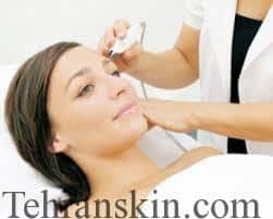 نتیجه تصویری برای لیزر درمانی برای ابرو ها