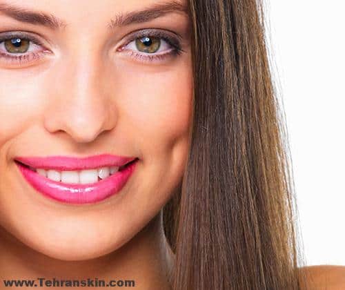 متخصص درمان چال گونه