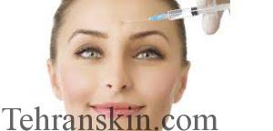 پاسخ به همه سؤال های شما در مورد تزریق بوتاکس ، قیمت ، عوارض و ماندگاری بوتاکس