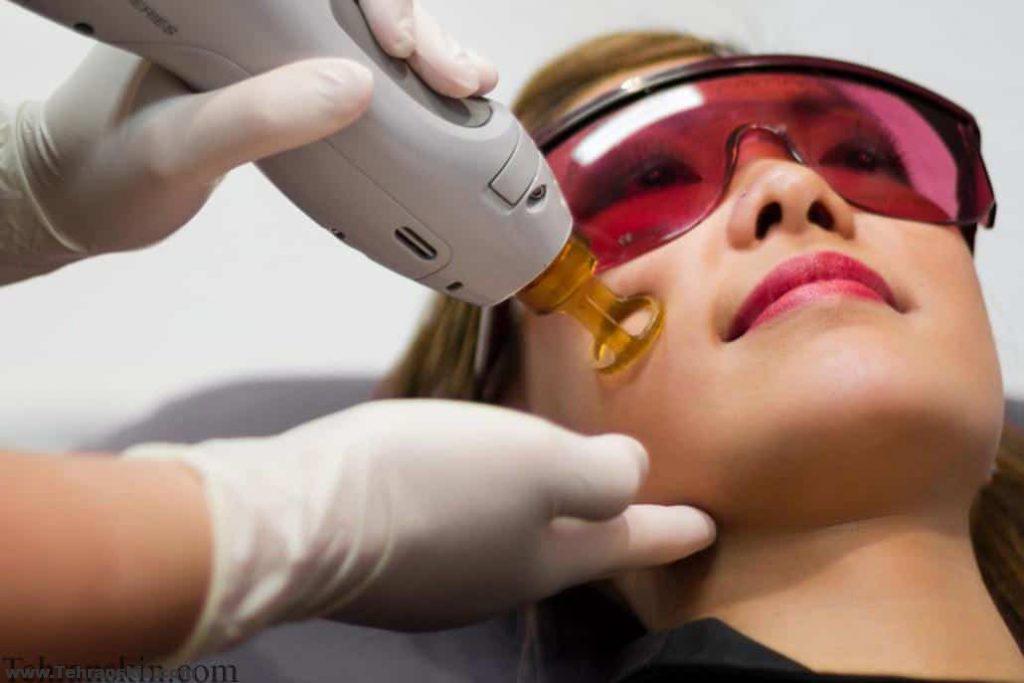 لیزردرمانی