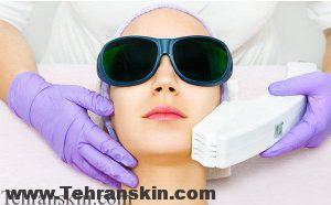 لیزر موهای زائد با دستگاه الکساندرایت و نکات مهمی که باید بدانید! لیزر بهتر است ؟ الکساندرایت یا IPL 2 300x186 - لیزر موهای زائد با دستگاه الکساندرایت و نکات مهمی که باید بدانید!