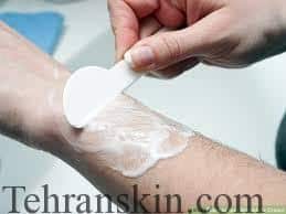 کرمهای موبر