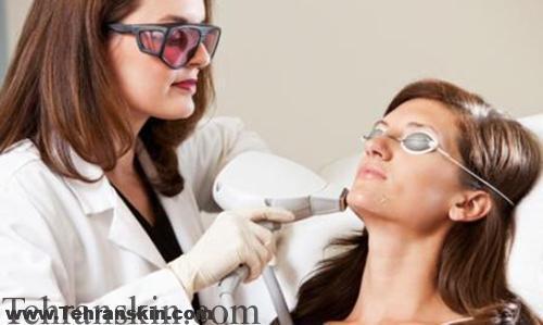 لیزر درمانی برای کک و مک