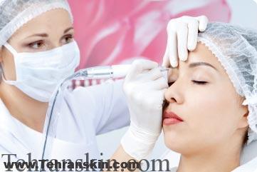 بهترین روش آرایش دائمی