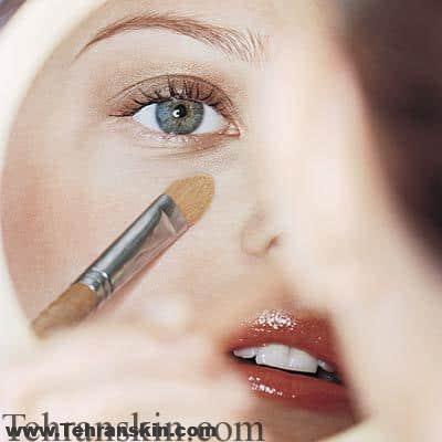 درمان های خانگی و لیزر برای رهایی از چین و چروک های زیر چشم + فیلم