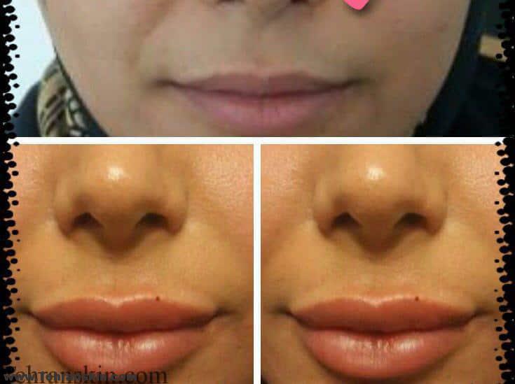 معرفی مراکز زیبایی در شیراز