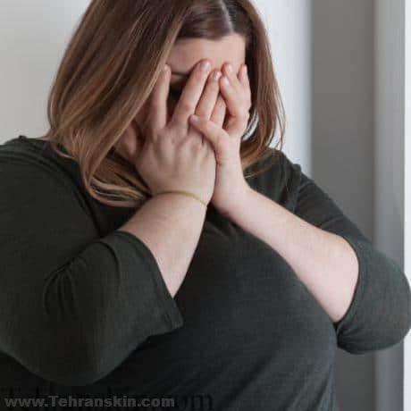 ارتباط چاقی با سلامت روانی