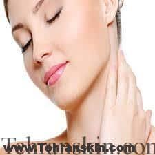 لیزر درمانی برای گردن