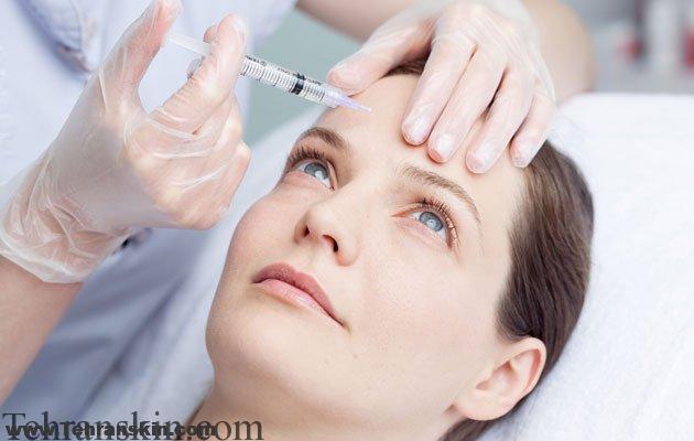 بوتاکس درمان جادویی برای زیبایی و سردرد میگرنی | مرکز لیزر و زیبایی برکه