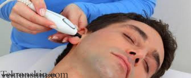 رفع موهای زائد گوش