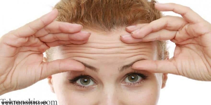 چین و چروک پوست