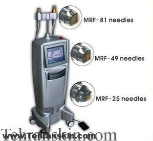 معرفی دستگاه جوانسازی آر اف فرکشنال میکرونیدل FRACTIONAL RF MICRONEEDLE