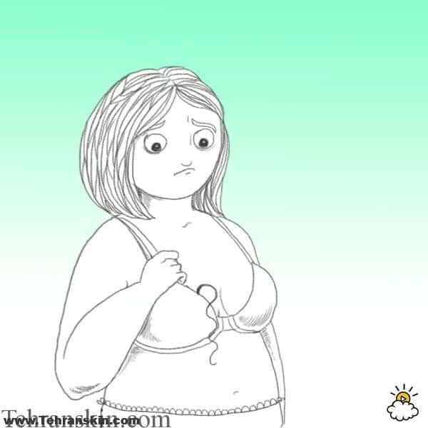 لیزر موهای زائد نوک سینه