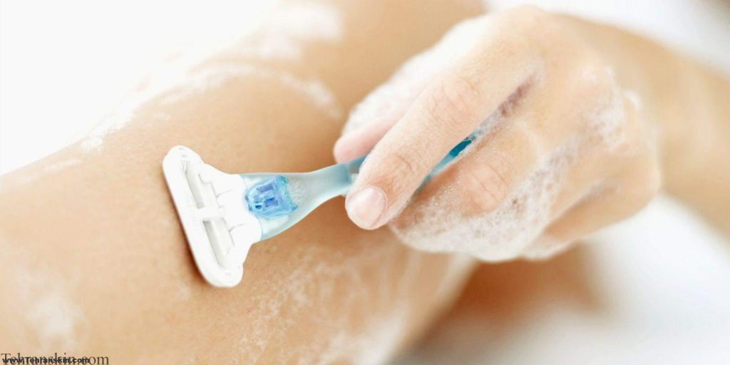 بهترین روش رفع موهای زائد