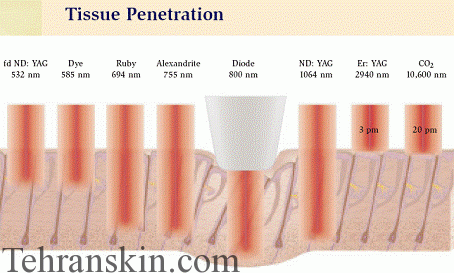 بهترین روش های لیزردرمانی ضایعات پوستی 