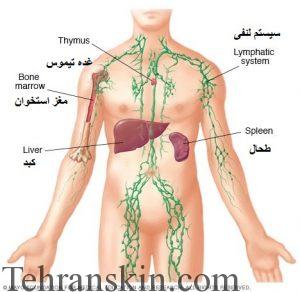 بهترین لیزر-تورم لنفی سیستم لنفی
