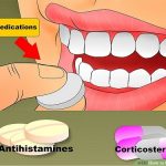 بهترین نکات لیزر درمانی و دارو