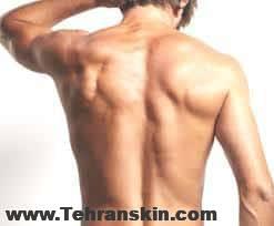 لیزر درمانی برای حذف مو های کمر و پشت مردان |بهترین مرکز لیزر موهای زائد