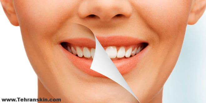 سوالات متداول حیطه ی دندانپزشکی