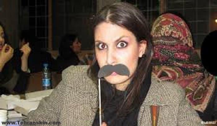 آسان ترین روش حذف مو های صورت