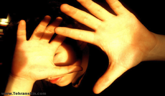 بدترین عوارض لیزر درماین