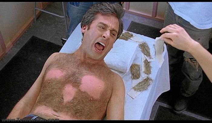 شدید ترین عوارض اپیلاسیون