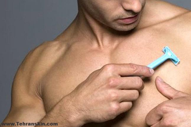 با لیزر درمانی به جنگ تیغ و موم بروید! حذف موهای ناخواسته سینه