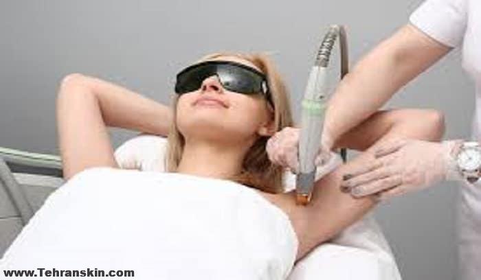 بهترین روش حذف موهای زیر بغل