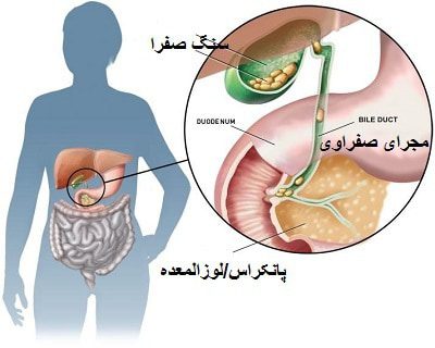 سنگ صفرا-پوست و مو: اثرات متقابل، بهترین درمان بیماری های پوست و مو