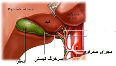 بهترین راههای درمان سنگ صفرا و درمان بیماری های پوست و مو