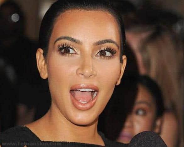 کیم کارداشیان