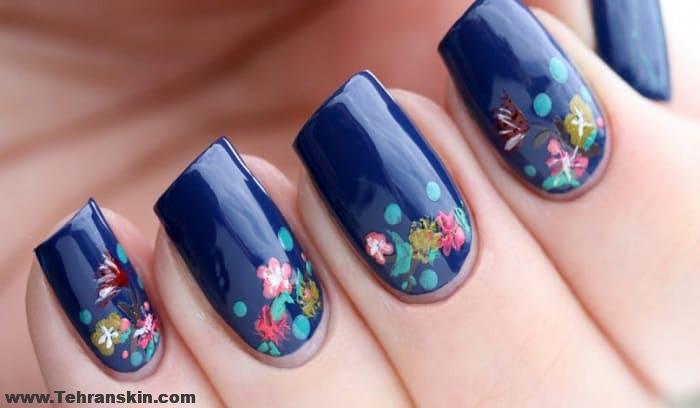 بهترین روش کاشت ناخن